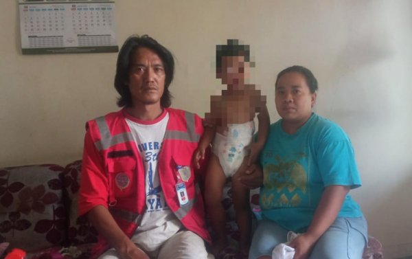 Pasca Operasi, Dua Tahun Balita di Kota Batu Ini Tergantung Pada Obat