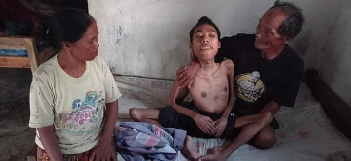 Butuh Bantuan, Roni Bocah Wajak Bertahun-tahun Hanya di Tempat Tidur